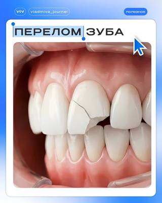 Перелом зуба: коронка или корень — тактика лечения разная.